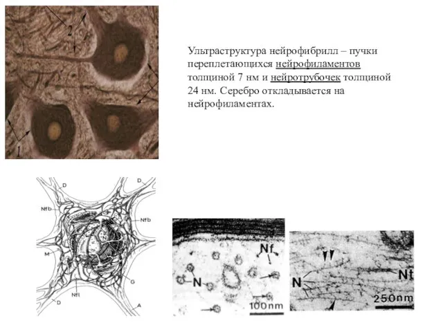 Ультраструктура нейрофибрилл – пучки переплетающихся нейрофиламентов толщиной 7 нм и нейротрубочек толщиной 24