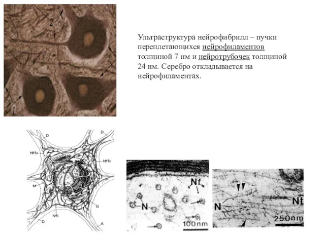 Ультраструктура нейрофибрилл – пучки переплетающихся нейрофиламентов толщиной 7 нм и