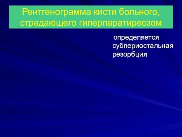 Рентгенограмма кисти больного, страдающего гиперпаратиреозом определяется субпериостальная резорбция