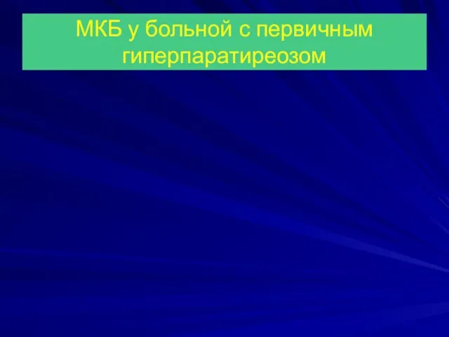 МКБ у больной с первичным гиперпаратиреозом