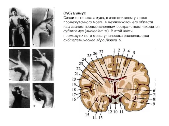 Субталамус Сзади от гипоталамуса, в задненижнем участке промежуточного мозга, в