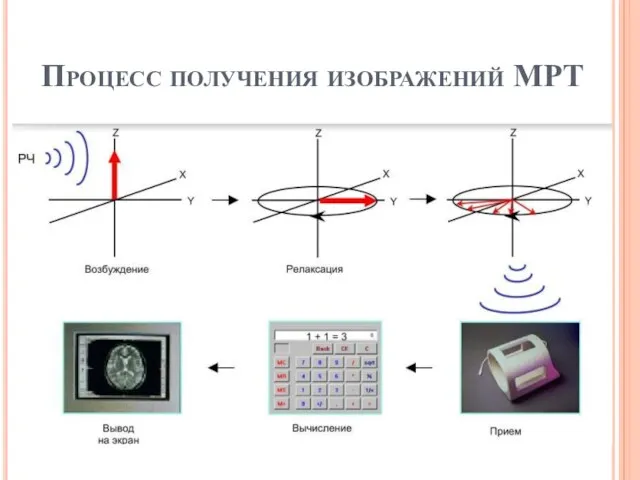 Процесс получения изображений МРТ