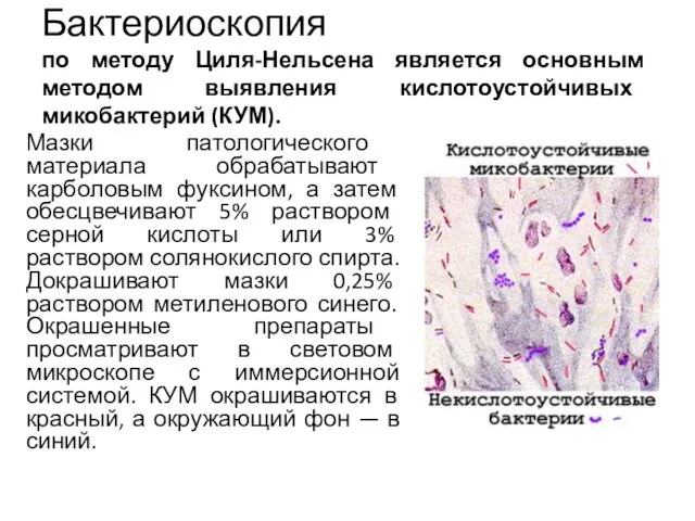 Бактериоскопия по методу Циля-Нельсена является основным методом выявления кислотоустойчивых микобактерий