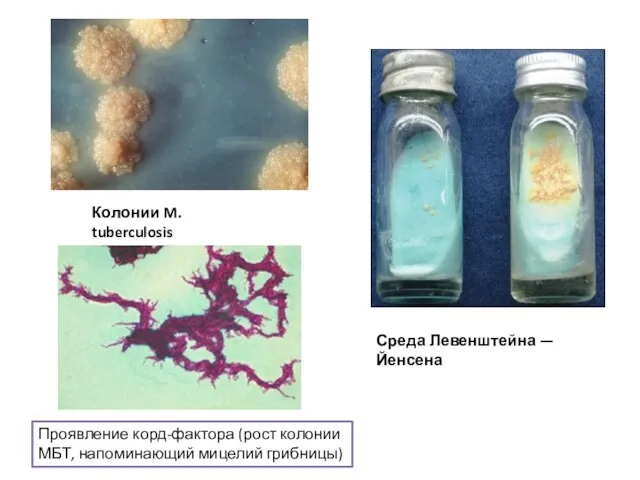 Колонии M. tuberculosis Среда Левенштейна — Йенсена Проявление корд-фактора (рост колонии МБТ, напоминающий мицелий грибницы)