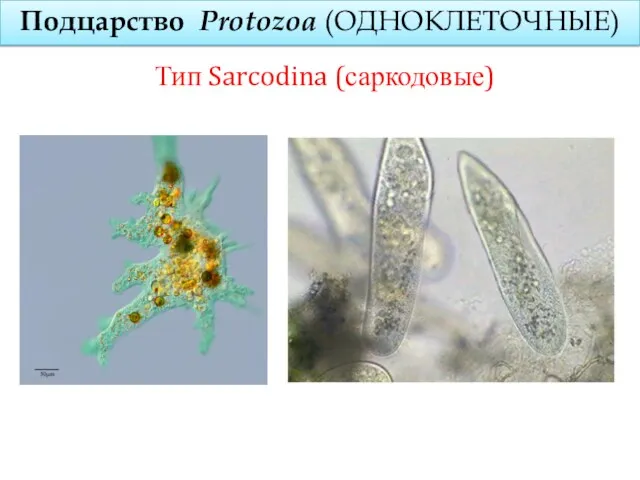 Подцарство Protozoa (ОДНОКЛЕТОЧНЫЕ) Тип Sarcodina (саркодовые)