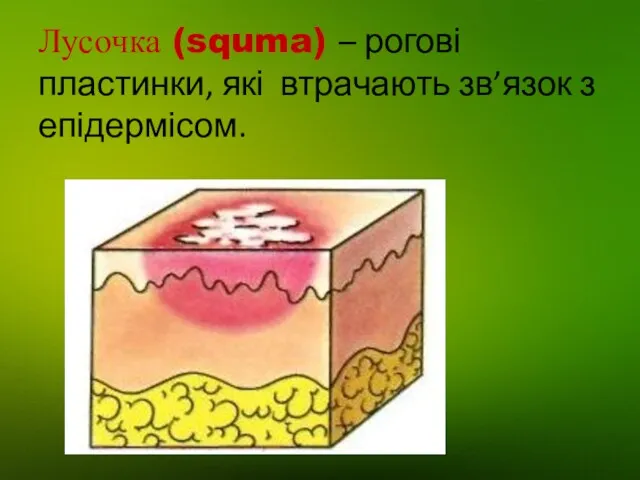 Лусочка (squma) – рогові пластинки, які втрачають зв’язок з епідермісом.