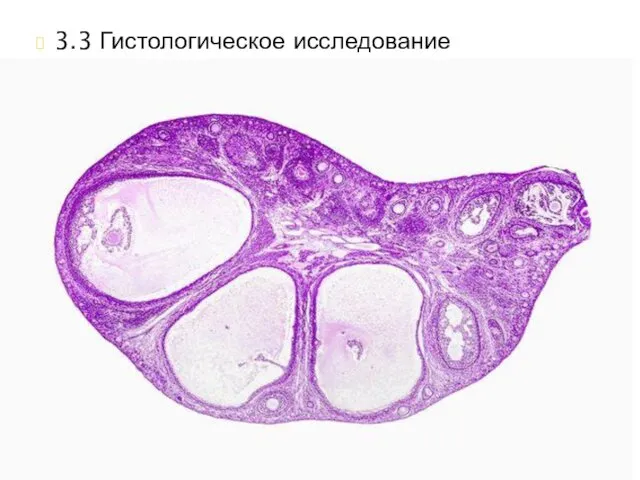 3.3 Гистологическое исследование