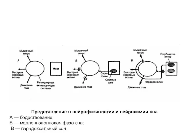 Представление о нейрофизиологии и нейрохимии сна А — бодрствование; Б