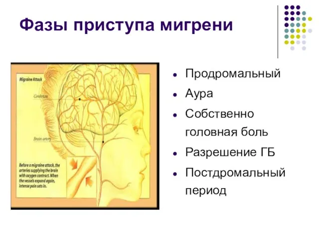 Фазы приступа мигрени Продромальный Аура Собственно головная боль Разрешение ГБ Постдромальный период