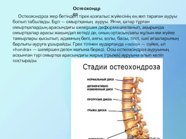 Остеохондроз жер бетіндегі тірек-қозғалыс жүйесінің ең көп тараған ауруы болып