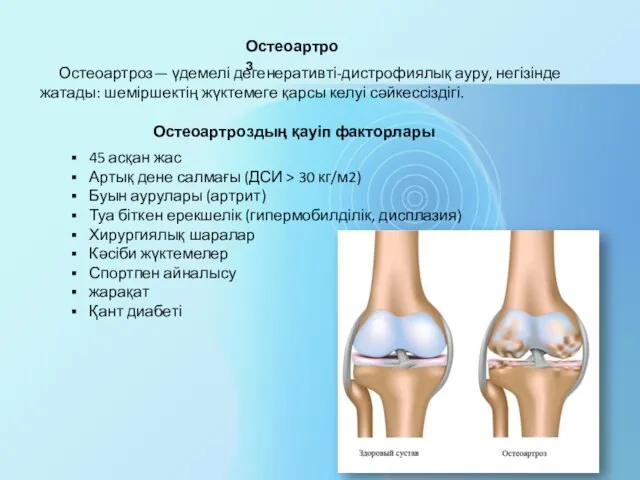 Остеоартроз— үдемелі дегенеративті-дистрофиялық ауру, негізінде жатады: шеміршектің жүктемеге қарсы келуі