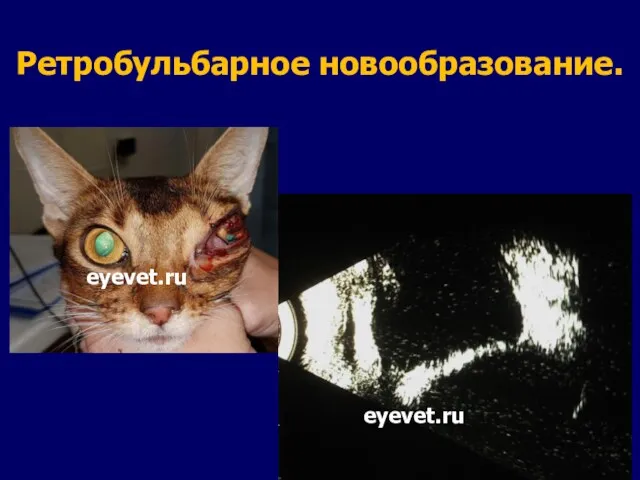 Ретробульбарное новообразование. eyevet.ru eyevet.ru