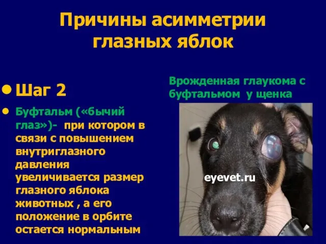 Причины асимметрии глазных яблок Шаг 2 Буфтальм («бычий глаз»)- при котором в связи