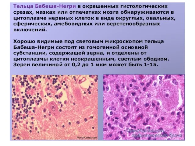 Тельца Бабеша-Негри в окрашенных гистологических срезах, мазках или отпечатках мозга