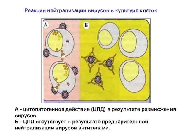 А - цитопатогенное действие (ЦПД) в результате размножения вирусов; Б