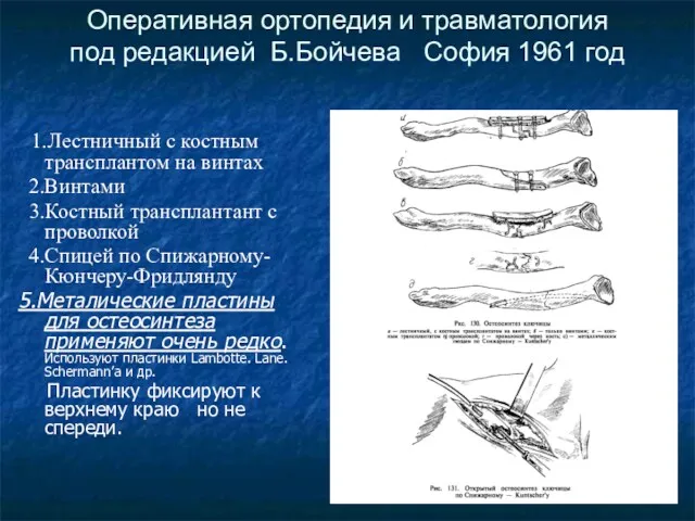 Оперативная ортопедия и травматология под редакцией Б.Бойчева София 1961 год