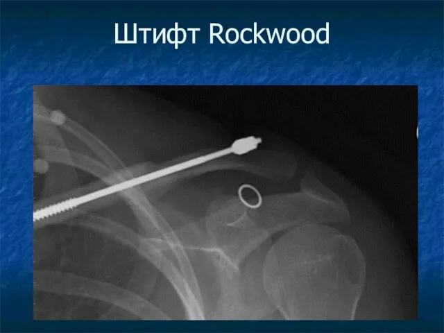 Штифт Rockwood