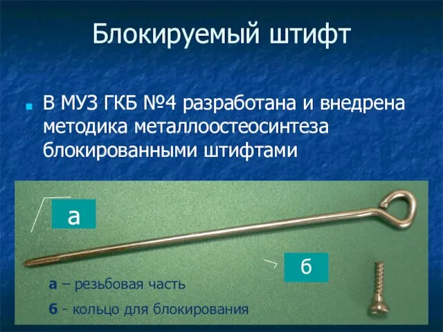 Блокируемый штифт В МУЗ ГКБ №4 разработана и внедрена методика