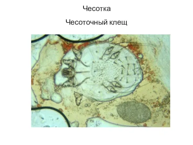 Чесотка Чесоточный клещ