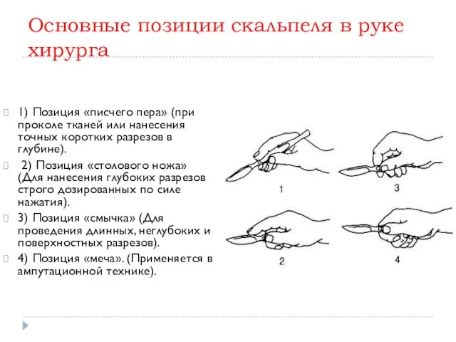 Основные позиции скальпеля в руке хирурга 1) Позиция «писчего пера»