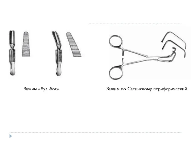 Зажим «Бульбог» Зажим по Сатинскому периферический