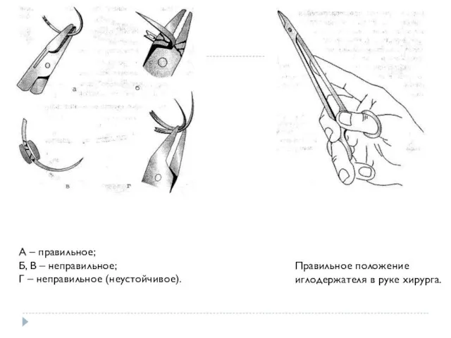 А – правильное; Б, В – неправильное; Г – неправильное