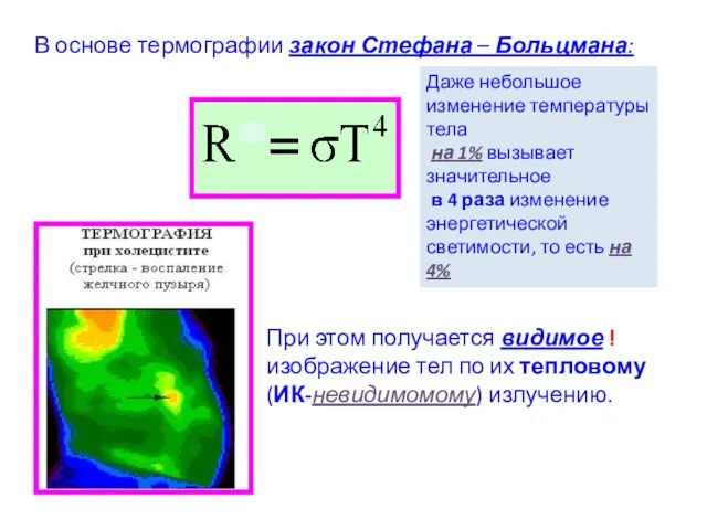 В основе термографии закон Стефана – Больцмана: Даже небольшое изменение