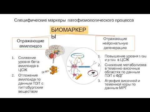 Отражающие амилоидоз Специфические маркеры патофизиологического процесса Снижение уровня бета-амилоида в