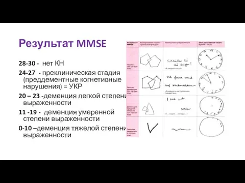 Результат MMSE 28-30 - нет КН 24-27 - преклиническая стадия