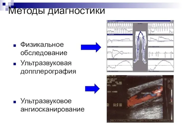 Методы диагностики Физикальное обследование Ультразвуковая допплерография Ультразвуковое ангиосканирование