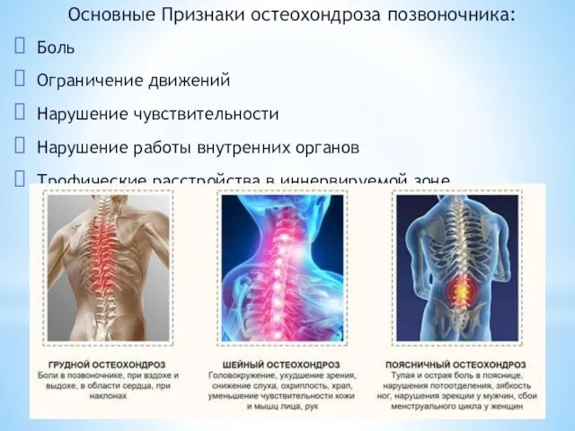 Основные Признаки остеохондроза позвоночника: Боль Ограничение движений Нарушение чувствительности Нарушение