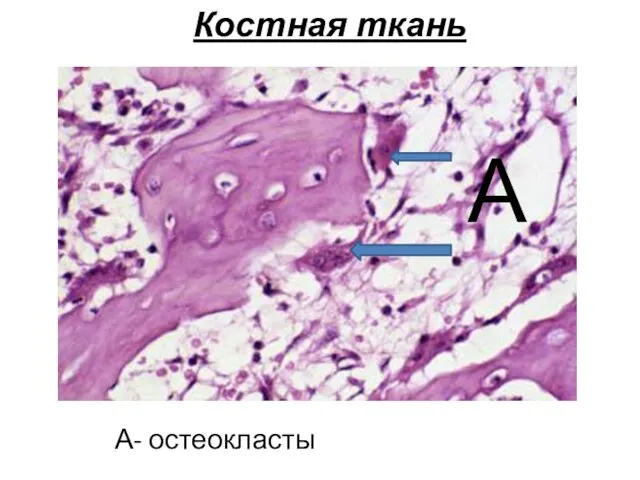 Костная ткань А- остеокласты А
