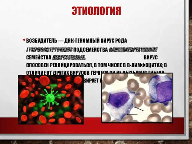 ЭТИОЛОГИЯ ВОЗБУДИТЕЛЬ — ДНК-ГЕНОМНЫЙ ВИРУС РОДА LYMPHOCRYPTOVIRUS ПОДСЕМЕЙСТВА GAMMAHERPESVIRINAE СЕМЕЙСТВА