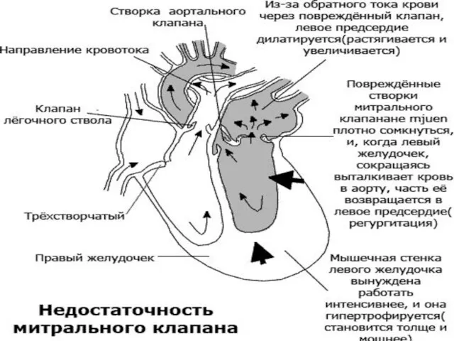 патогенез