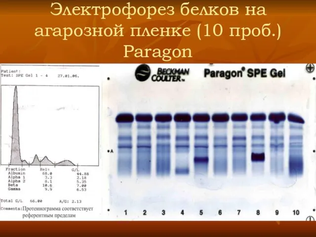 Электрофорез белков на агарозной пленке (10 проб.) Paragon
