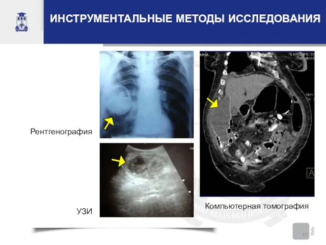 ИНСТРУМЕНТАЛЬНЫЕ МЕТОДЫ ИССЛЕДОВАНИЯ УЗИ Рентгенография Компьютерная томография