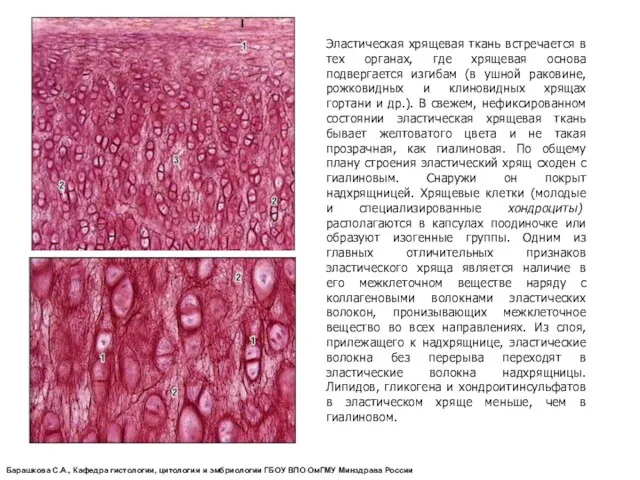 Эластическая хрящевая ткань встречается в тех органах, где хрящевая основа подвергается изгибам (в