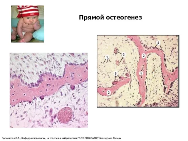 Прямой остеогенез Барашкова С.А., Кафедра гистологии, цитологии и эмбриологии ГБОУ ВПО ОмГМУ Минздрава России