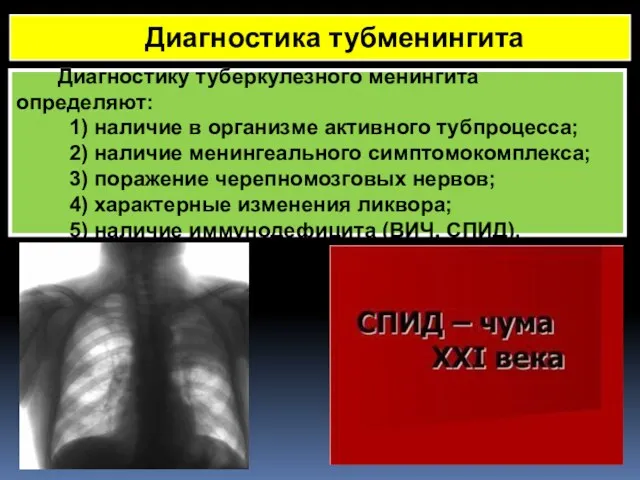 Диагностику туберкулезного менингита определяют: 1) наличие в организме активного тубпроцесса;