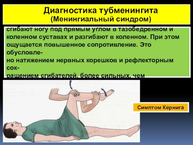 Симптом Кернига - больному, лежащему на спине, сгибают ногу под