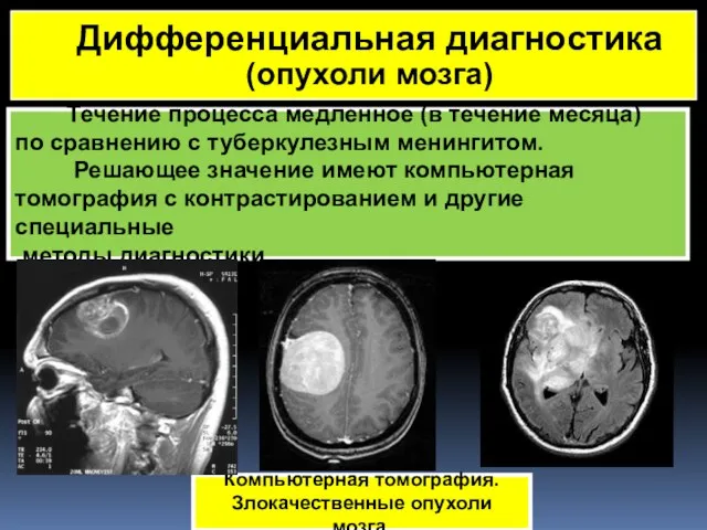 Течение процесса медленное (в течение месяца) по сравнению с туберкулезным