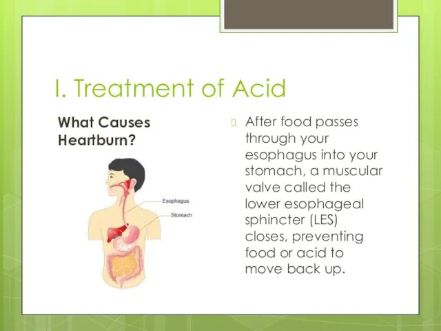 I. Treatment of Acid What Causes Heartburn? After food passes through your esophagus