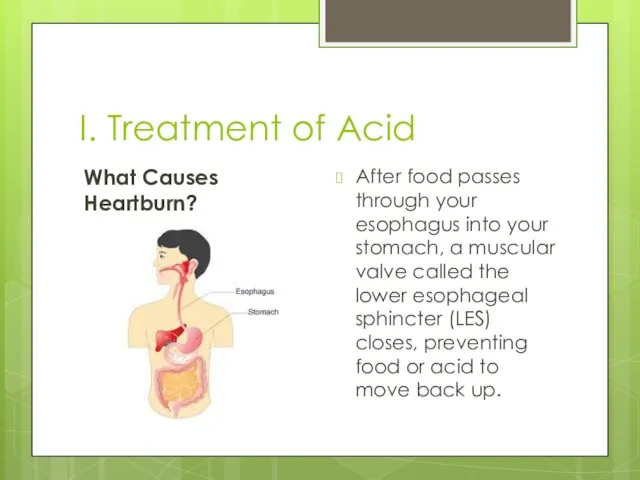 I. Treatment of Acid What Causes Heartburn? After food passes