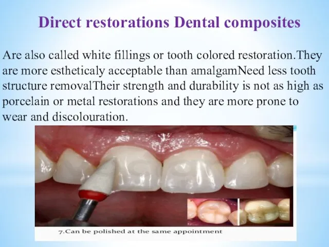 Are also called white fillings or tooth colored restoration.They are more estheticaly acceptable