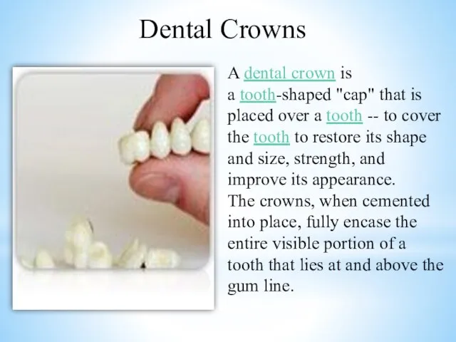 A dental crown is a tooth-shaped "cap" that is placed over a tooth