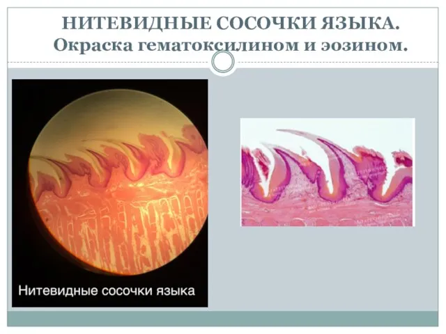 НИТЕВИДНЫЕ СОСОЧКИ ЯЗЫКА. Окраска гематоксилином и эозином.