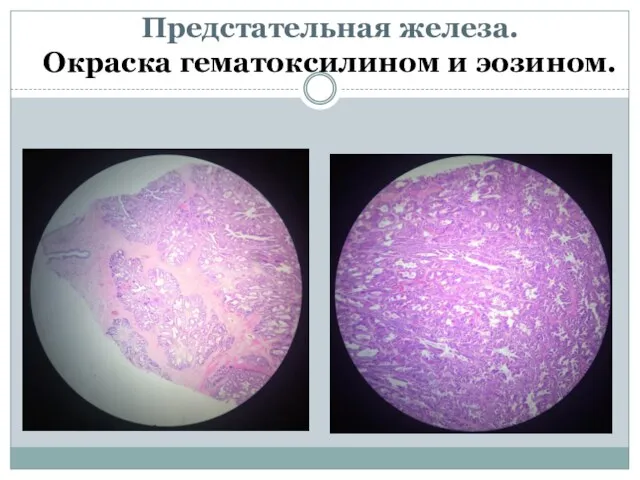 Предстательная железа. Окраска гематоксилином и эозином.