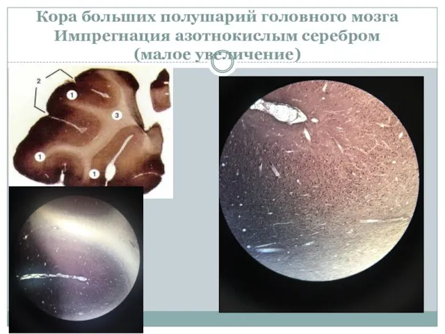 Кора больших полушарий головного мозга Импрегнация азотнокислым серебром (малое увеличение)