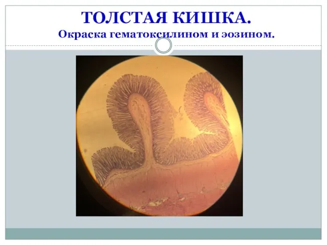 ТОЛСТАЯ КИШКА. Окраска гематоксилином и эозином.