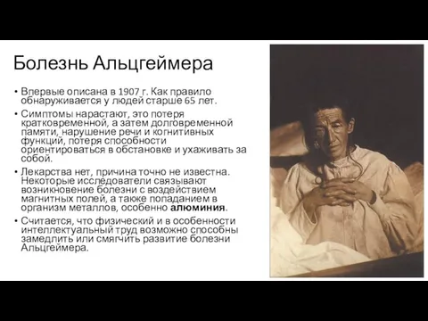 Болезнь Альцгеймера Впервые описана в 1907 г. Как правило обнаруживается у людей старше